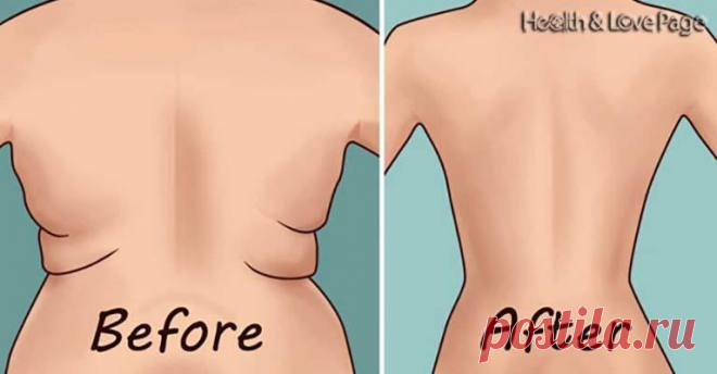 Eliminate Back Fat and Underarm Flab with 4 Quick Exercises