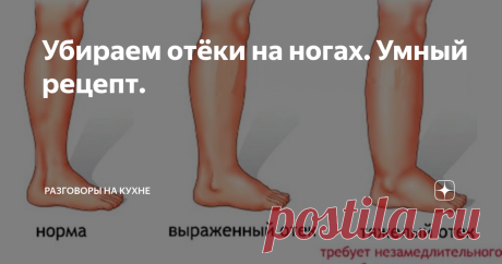 Убираем отёки на ногах. Умный рецепт. Часть 2 (делай сам подскажи другому)
Отёки на ногах, свидетельствует о максимальном содержании солей и токсинов в этих тканях!  Именно причины отёков и  вызывают болезни, в том числе почек и сердца.
Три  основные причины вызывающие отёки:
1. Где отёк, там и есть  накопление неорганических солей и шлаков в мягких тканях. Накопившееся  соль притягивает воду. Чем ближе к земле участок тела, тем он бо