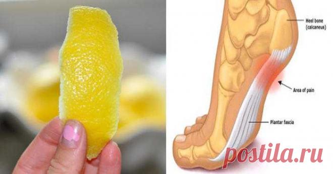 Хитрость лимонной кожуры против воспаления и боли! — Домашние