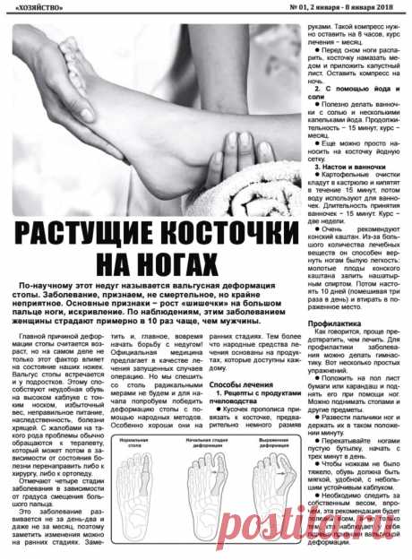 Растущие косточки на ногах