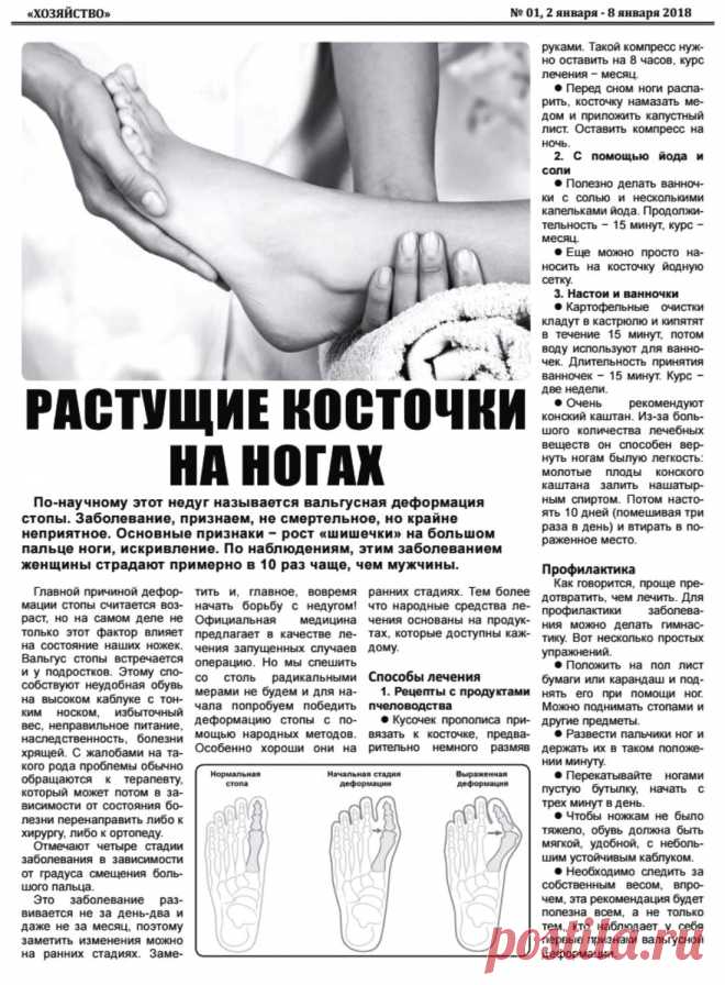 Растущие косточки на ногах
