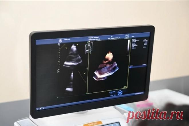 Зачем гипертоникам назначают УЗИ сердца Людям, страдающим гипертонией, необходимо ежегодно проходить УЗИ сердца (ЭХОКГ), так как оно помогает заметить изменения в работе сердца на ранних стадиях, рассказал в своем Telegram-канале кардиолог Тамаз Гаглошвили.