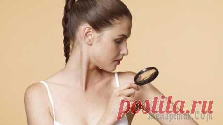 Родинка — пигментный невус: причины появления, удаление. Что будет, если содрать родинку?