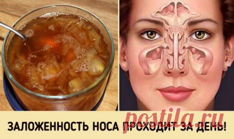 Супер-средство от заложенного носа. Будете свободно дышать уже на утро! — Копилочка полезных советов