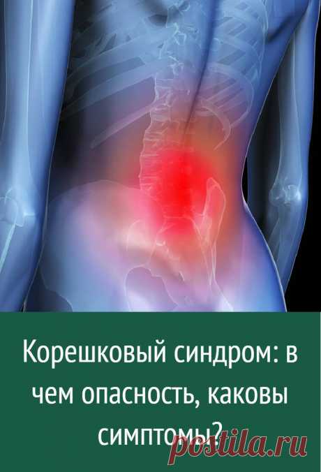 Корешковый синдром: в чем опасность, каковы симптомы?