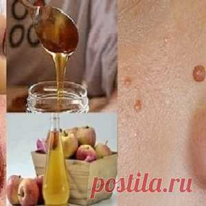 Народные средства для удаления родинок, бородавок, угрей и возрастных пятен