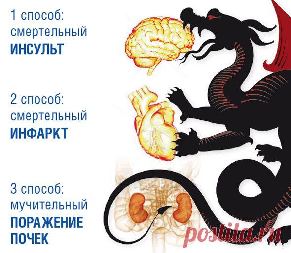 Если гипертонию не лечить…