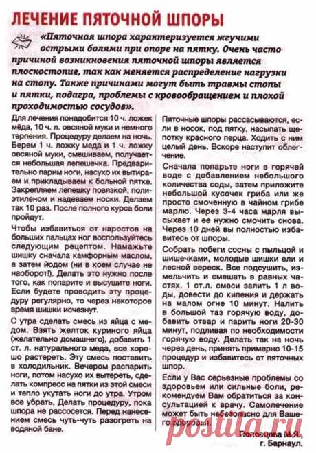 Лечение пяточной шпоры