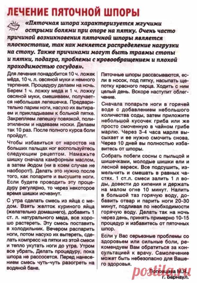 Лечение пяточной шпоры