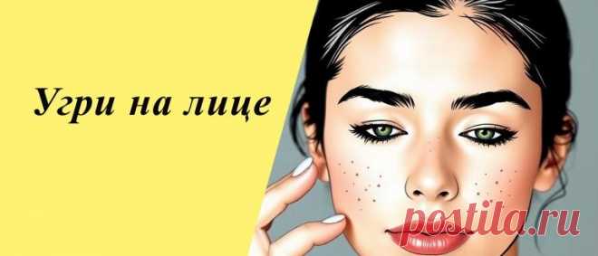 Эффективные методы избавления от угрей и акне на коже Узнайте эффективные методы борьбы с угрями: домашние средства, процедуры и советы специалистов для чистой и здоровой кожи.