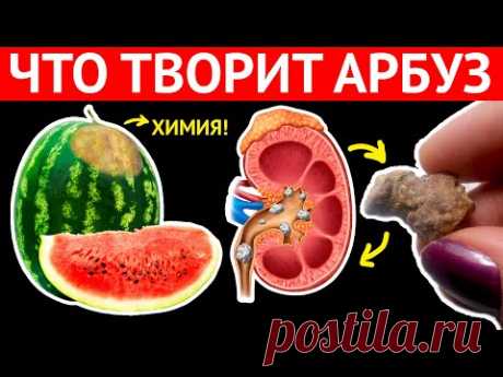 Даже один кусочек АРБУЗА, может вызвать НЕОБРАТИМЫЕ ПРОЦЕССЫ. Арбуз с химикатами повышает угрозу…
