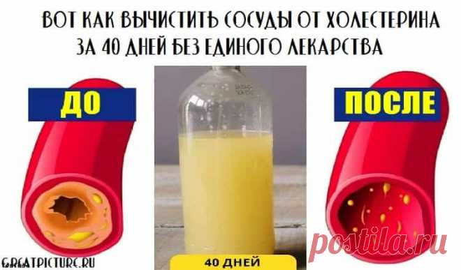 Вот как вычистить сосуды от холестерина за 40 дней без единого лекарства