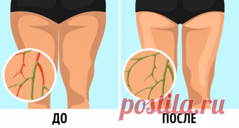 Вес  стоит и не уходит? 6 простых упражнений по разгону лимфы, с которыми худеют и без диет Предлагаем вашему вниманию простой комплекс упражнений, которые отлично справляются с задачей разгона лимфы. Особенно он будет полезен тем, чья физическая активность оставляет желать лучшего. Хотите похудеть, но вес стоит на месте? Замечаете у себя отечность лица и тела, проблемную кожу,...