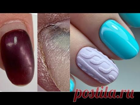 Огромный синяк😳ПОКРЫВАТЬ ИЛИ НЕТ? Вязаный осенний  дизайн ногтей/Чистый маникюр
