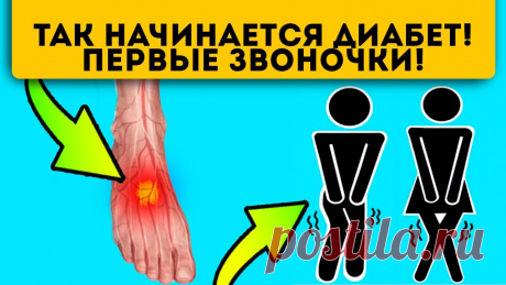 По каким признакам можно узнать, что у вас высокий сахар в крови
