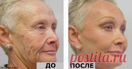 Ей 64 года, но все завидуют ее лицу без морщин! Ее тайна - один-единственный ингредиент!  Молодильные яблоки уже не нужны :)