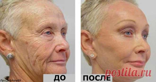 Ей 64 года, но все завидуют ее лицу без морщин! Ее тайна - один-единственный ингредиент!  Молодильные яблоки уже не нужны :)