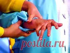 Подагра (наросты на костях) - лечение народными средствами