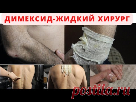 Что творит димексид?.Если не знали, то повторите! Боль исчезнет !. ЖИДКИЙ ХИРУРГ.