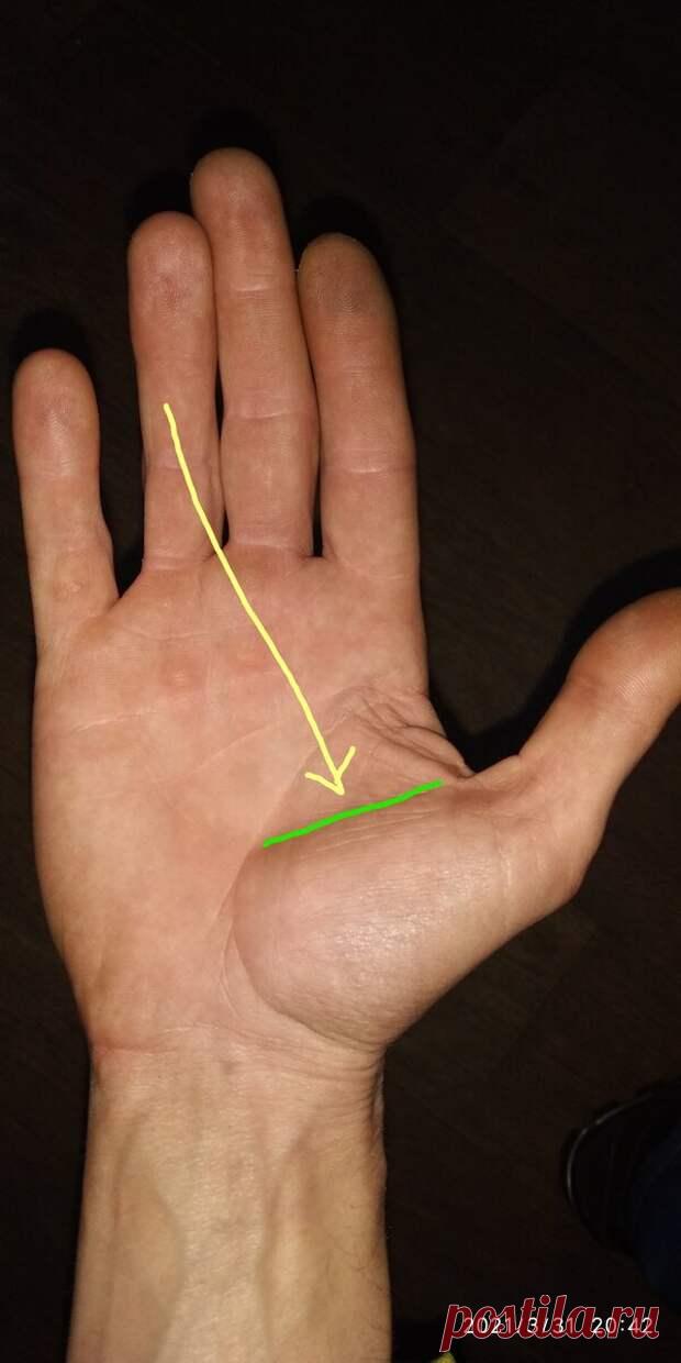 Линия порчи на руке, указывающая на негатив или магическое воздействие - Сонники, гороскопы, гадания - медиаплатформа МирТесен По рукам можно посмотреть много информации, даже посмотреть есть ли на Вас негативное магическое воздействие? Тема очень обширная, предлагаю в этой статье показать примеры таких линий и рассказать Вам что она обозначает. Итак, где? на холме Венеры врезанная как будто ножом горизонтальная (может