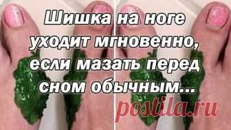 Как избавиться от шишки на большом пальце ноги