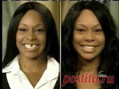 Cosmetic Dentistry Extreme Makeover in Manhattan