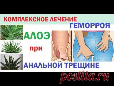 Комплексное лечение геморроя и анальной трещины/Алоэ для лечения геморроя и анальных трещин
