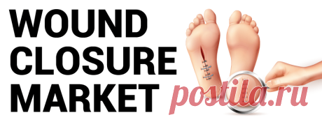 Wound Closure Market Size, Share, Growth | Global Report, 2026