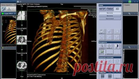 Цветной 3D-рентген обнаружит смертельные заболевания Ученые из Новой Зеландии впервые сделали цветные трехмерные рентгеновские снимки тела человека.