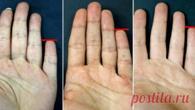 Ваш мизинец – кладезь секретной информации о характере! В Индии его называют палец Будды, римляне величали пальцем Меркурия, а хироманты связывают мизинец со всевозможными видами общения. Мизинец (или оба, поскольку они бывают разной длины и формы у одного человека) могут многое рассказать о том,