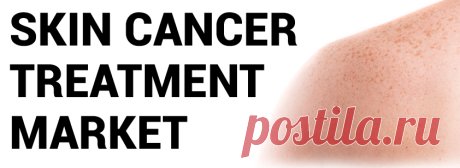 Skin Cancer Treatment Market Size, Share, Growth &amp; Trends, 2027