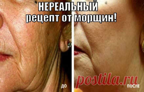 САМЫЙ ПРОСТОЙ РЕЦЕПТ ОТ МОРЩИН. ЭФФЕКТ НЕРЕАЛЬНЫЙ! 

Из народных средств против старения хорошо протирать кожу лица прохладным соляным раствором. Для этого в 1 стакан кипяченой воды добавьте 1 чайную ложку соли, и размешайте. Смочите ватный тампон в этой смеси и протрите лицо и шею легкими похлопывающими движениями.  
Также можно утром после умывания накладывать горячие компрессы на лицо. Небольшое полотенце опустите в горячую воду, затем отожмите и приложите к лицу, захватывая также и шею