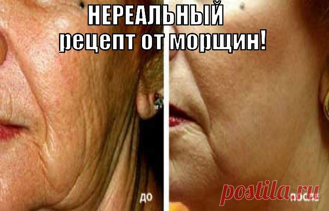 САМЫЙ ПРОСТОЙ РЕЦЕПТ ОТ МОРЩИН. ЭФФЕКТ НЕРЕАЛЬНЫЙ! 

Из народных средств против старения хорошо протирать кожу лица прохладным соляным раствором. Для этого в 1 стакан кипяченой воды добавьте 1 чайную ложку соли, и размешайте. Смочите ватный тампон в этой смеси и протрите лицо и шею легкими похлопывающими движениями.  
Также можно утром после умывания накладывать горячие компрессы на лицо. Небольшое полотенце опустите в горячую воду, затем отожмите и приложите к лицу, захватывая также и шею