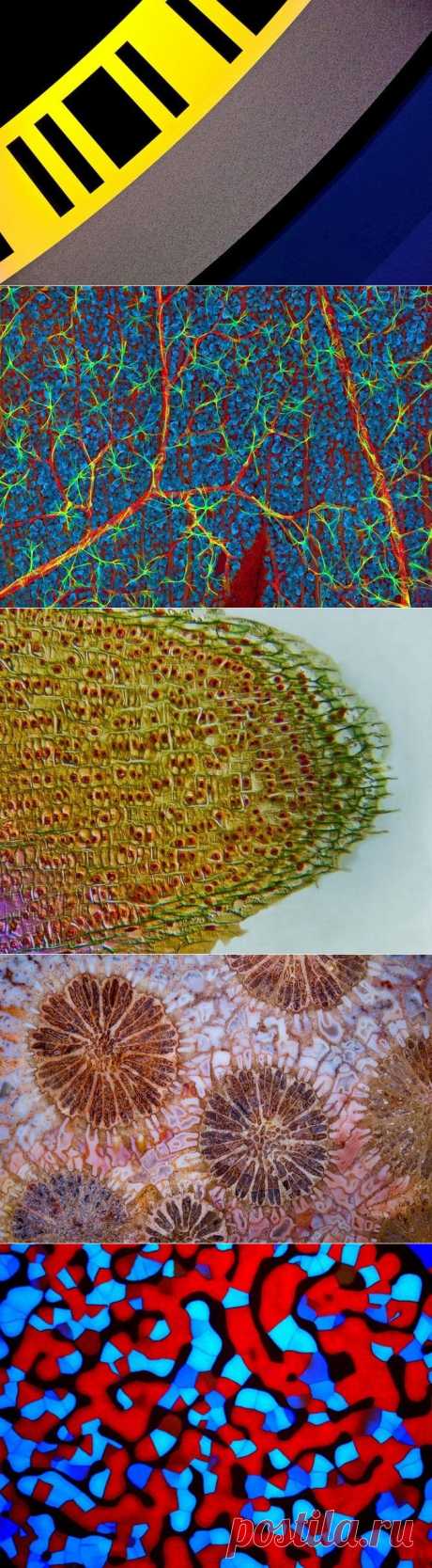 Снимки финалистов конкурса Nikon Small World 2015 — Фотоискусство
