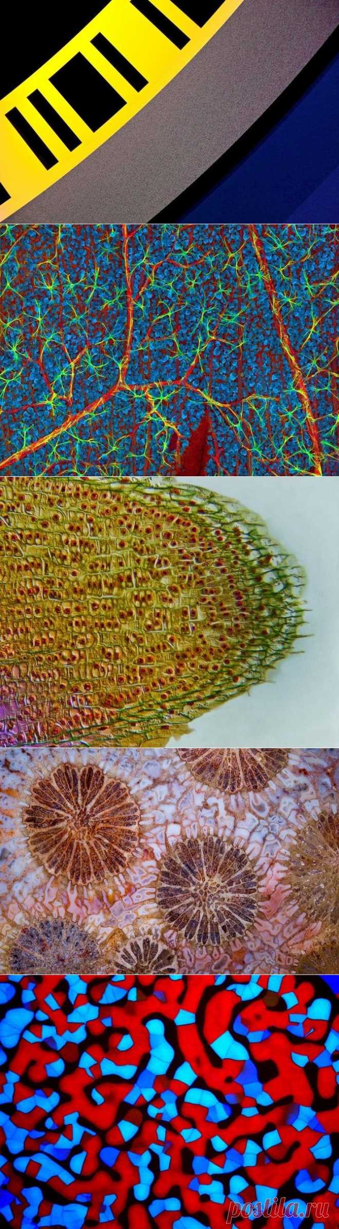 Снимки финалистов конкурса Nikon Small World 2015 — Фотоискусство