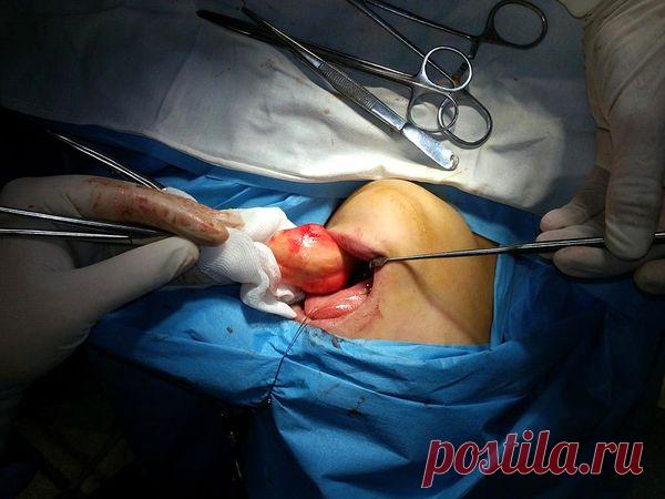 Ещё 18 фактов о нашем теле, которые расскажут то, чего вы о себе не знали | Умкра