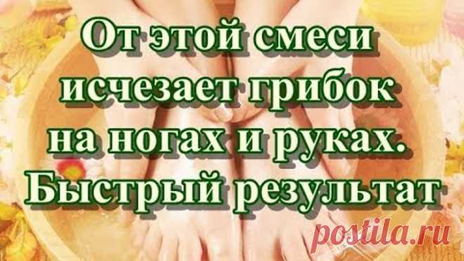 От этой смеси исчезает грибок на ногах и руках. Быстрый результат