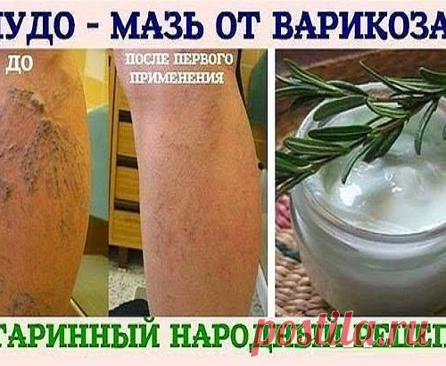 ЧУДО - МАЗЬ ОТ ВАРИКОЗА