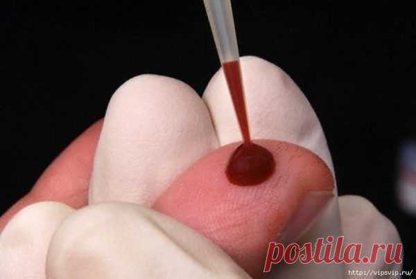 КАК РАЗЖИЖАТЬ ГУСТУЮ КРОВЬ БЕЗ ЛЕКАРСТВ — Полезные советы домохозяйкам