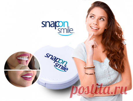 Snap-On Smile | Съемные виниры для красивой улыбки