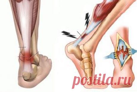 >> Сухожилия – воспаление, растяжение, разрыв и повреждение сухожилий кисти, стопы, на пальцах и на ногах. Боль в сухожилиях