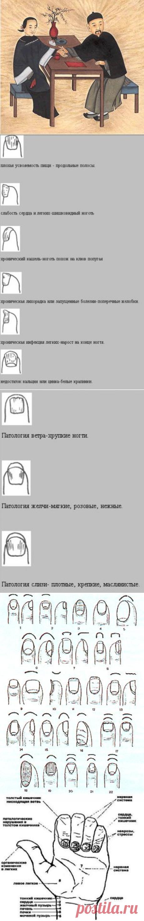 Диагностика по ногтям в восточной медицине