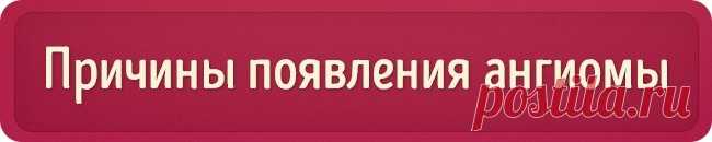 Что означают эти красные точки на коже? — СОВЕТНИК