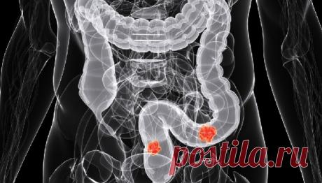 Этот фрукт назван одним из лучших продуктов против рака!