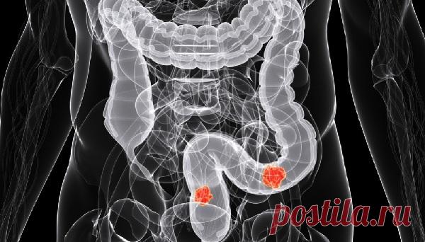 Этот фрукт назван одним из лучших продуктов против рака!