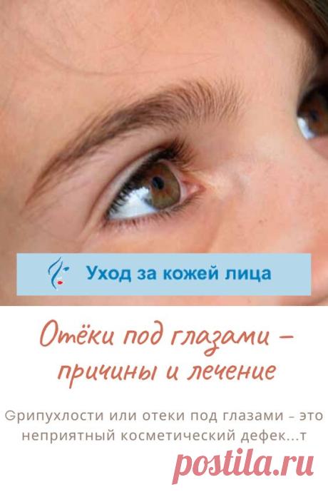 Отеки зоны под глазами – распространенная проблема, доставляющая немало неудобств. Подкожная ткань в этих местах имеет очень рыхлую структуру и почти не содержит коллагеновых волокон. Кроме того, кожа под глазами постоянно подвергается сжатию и растяжению – когда человек зажмуривается, моргает и т.д. Все это создает предпосылки для возникновения так называемых мешков, придающих лицу усталый и болезненный вид и визуально добавляющих возраст.