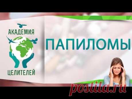 Папиломы ( Академия Целителей )