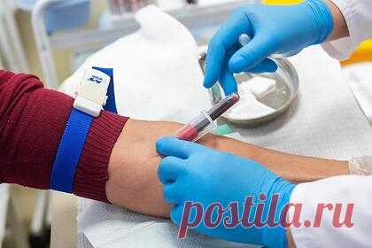 Ведущий Первого канала назвал главные симптомы опасной инфекции. Врач педиатр-иммунолог и ведущий программы «Жить здорово!» на Первом канале Андрей Продеус перечислил признаки, которые указывают на столбняк. Кроме того, специалист рассказал, какая бактерия является возбудителем этого тяжелого инфекционного заболевания и где ее можно чаще всего встретить.