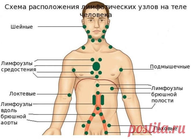 Лимфаденит: 80% того, что мы делаем, вредит нашему здоровью