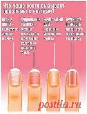 Диагностика здоровья по ногтям